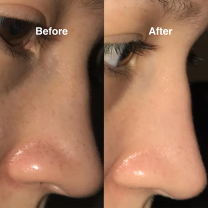 Glow Hydro Facial